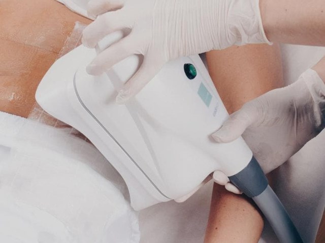 CRIOLIPOLISIS (2 ZONAS)