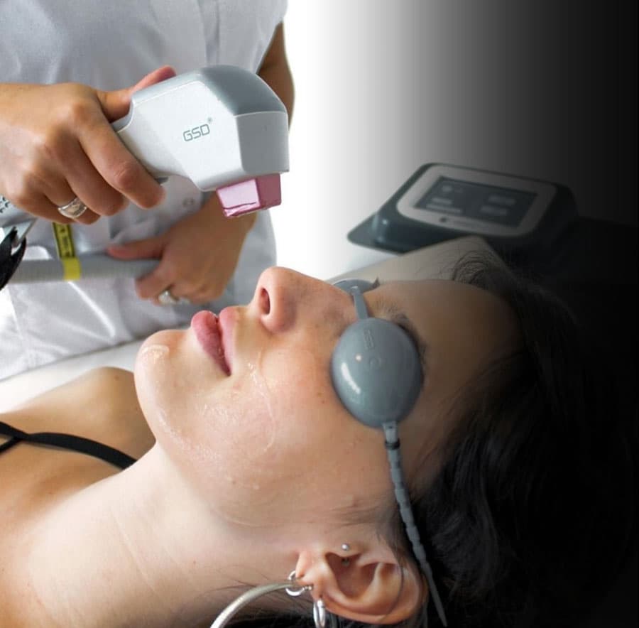 Tratamientos faciales en Viveiro